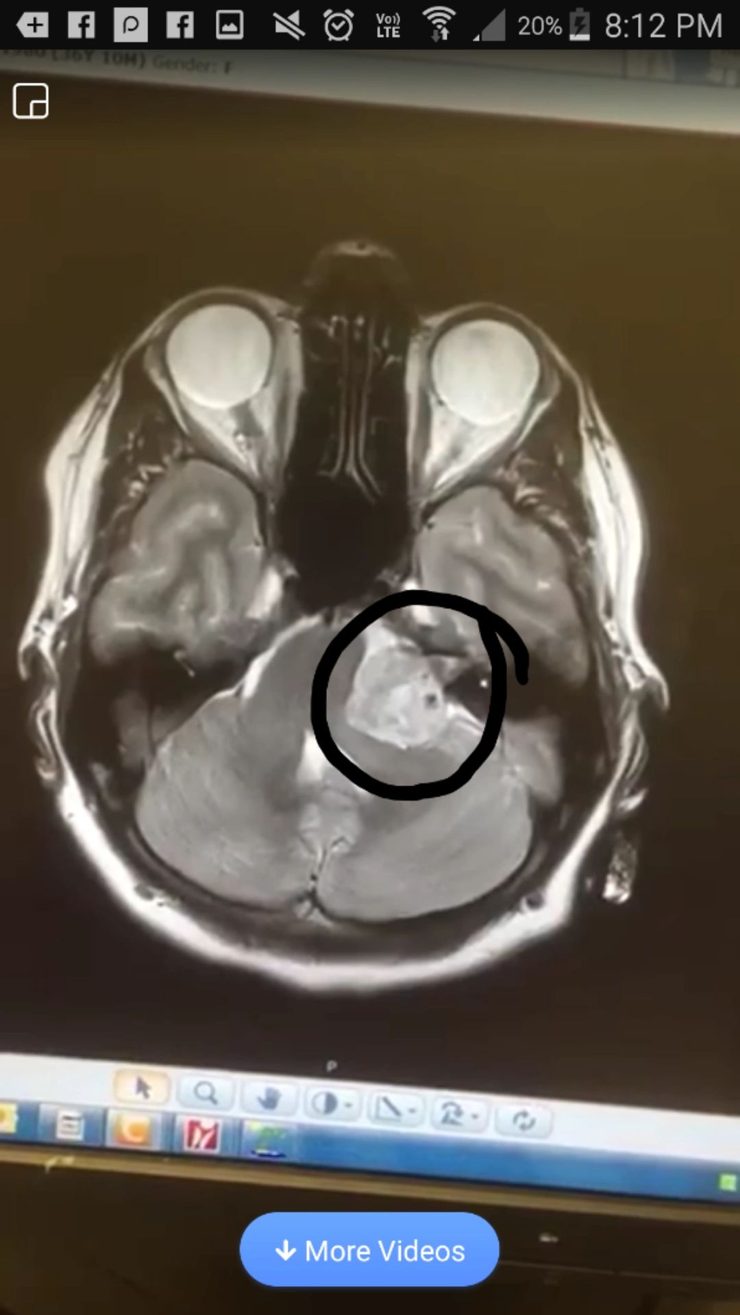 Can I breastfeed/ chestfeed after having an MRI, CT or Xray?